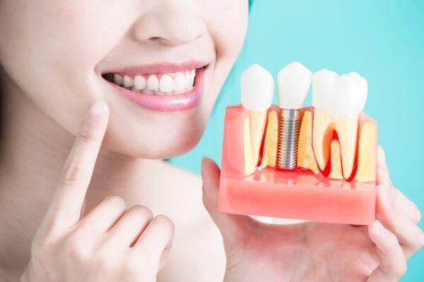 What are the Most Common Dental Misconceptions?