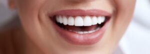 Everything You Need to Know About Cosmetic Dentistry